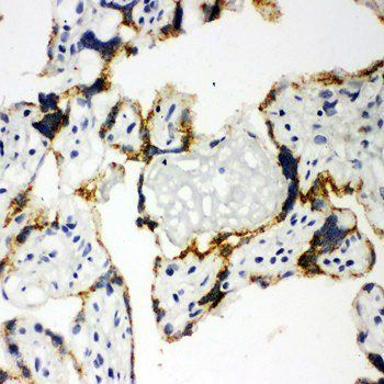 CYP11A1 Rabbit Polyclonal Antibody