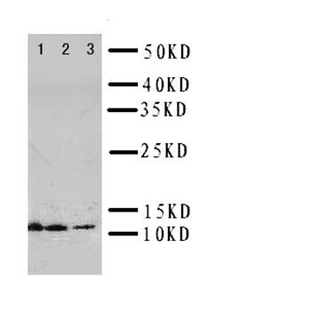 Interleukin-13 IL13/13 Rabbit Polyclonal Antibody