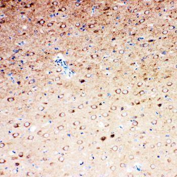 Serotonin transporter/SLC6A4 Rabbit Polyclonal Antibody