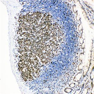 MCM2 Rabbit Polyclonal Antibody
