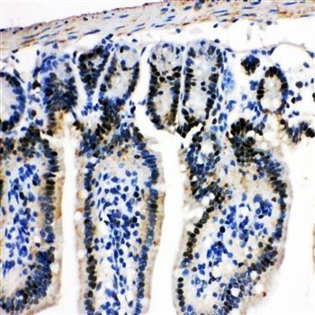 MCM2 Rabbit Polyclonal Antibody