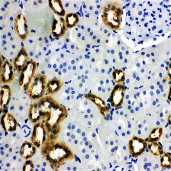 PBP/PEBP1 Rabbit Polyclonal Antibody