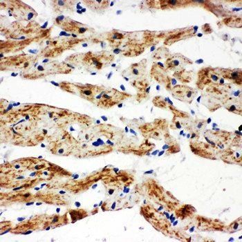 SDHB Rabbit Polyclonal Antibody
