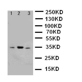 SDHB Rabbit Polyclonal Antibody