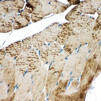 SERCA1 ATPase/ATP2A1 Rabbit Polyclonal Antibody