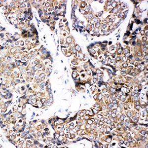 ABCB6 Rabbit Polyclonal Antibody