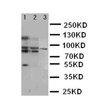 ABCB6 Rabbit Polyclonal Antibody