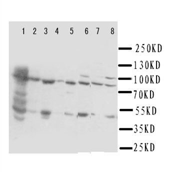 Hydroxysteroid (17-beta) Dehydrogenase 4/HSD17B4 Antibody