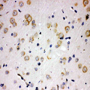 PAK6 Rabbit Polyclonal Antibody