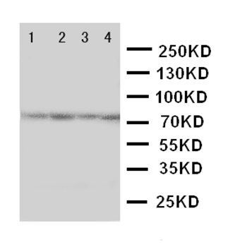 PAK6 Rabbit Polyclonal Antibody