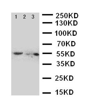 Glucose Transporter 5 GLUT5/SLC2A5 Rabbit Polyclonal Antibody