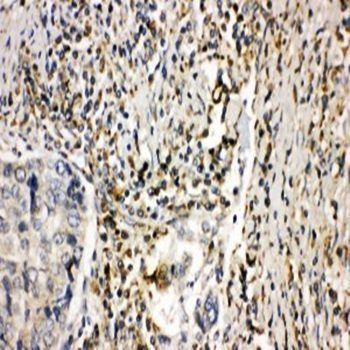 NADPH oxidase 1 NOX1 Rabbit Polyclonal Antibody