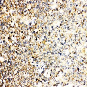 Interleukin-3 IL3 Rabbit Polyclonal Antibody