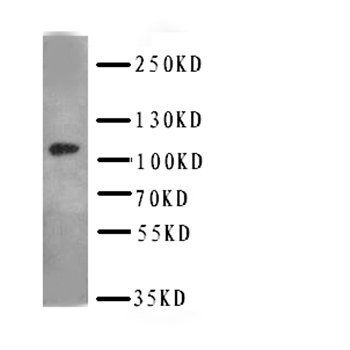 DPYD Rabbit Polyclonal Antibody