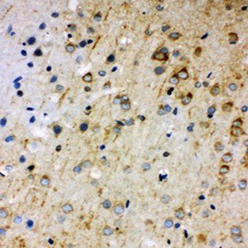 Rab5/RAB5A Rabbit Polyclonal Antibody