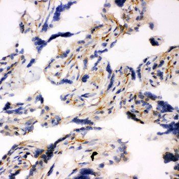 SNAP23 Rabbit Polyclonal Antibody