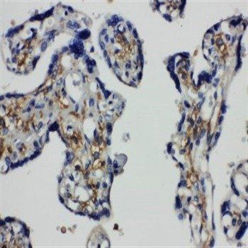 SNAP23 Rabbit Polyclonal Antibody