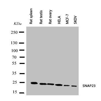 SNAP23 Rabbit Polyclonal Antibody