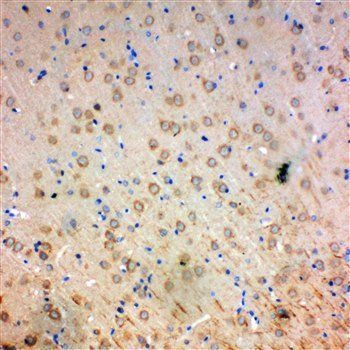 SOD2 Rabbit Polyclonal Antibody
