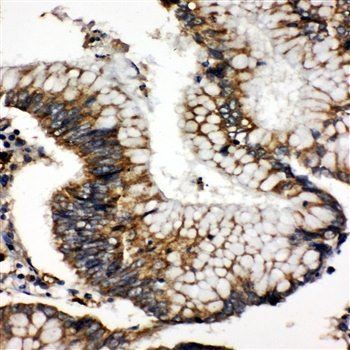 SOD2 Rabbit Polyclonal Antibody