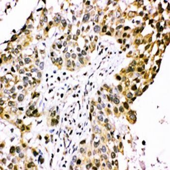 CISH Rabbit Polyclonal Antibody