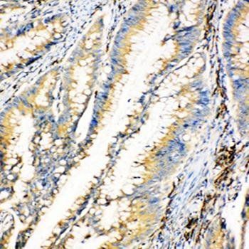HEXA Rabbit Polyclonal Antibody