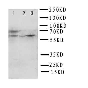 HEXA Rabbit Polyclonal Antibody