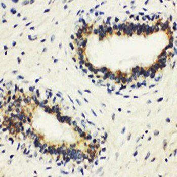HLA DMB/HLA-DMB Antibody