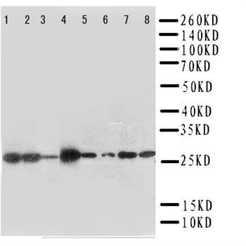 LIM and SH3 domain protein 1 LASP1 Rabbit Polyclonal Antibody