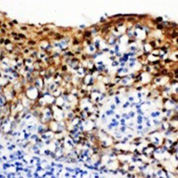 14-3-3 sigma/SFN/14 Rabbit Polyclonal Antibody