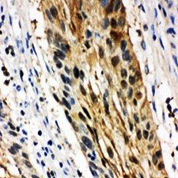 14-3-3 sigma/SFN/14 Rabbit Polyclonal Antibody