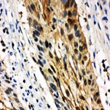 14-3-3 sigma/SFN/14 Rabbit Polyclonal Antibody
