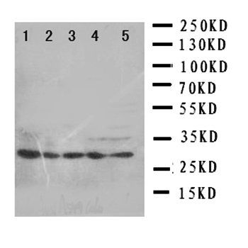 14-3-3 sigma/SFN/14 Rabbit Polyclonal Antibody