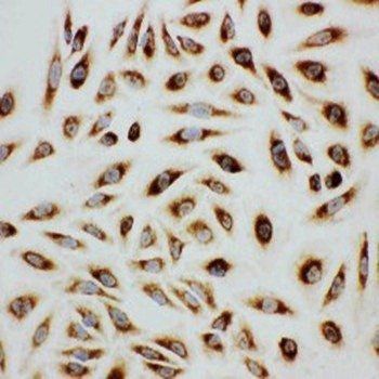 Paxillin/PXN Rabbit Polyclonal Antibody