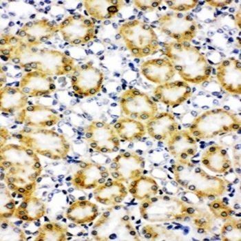 Paxillin/PXN Rabbit Polyclonal Antibody