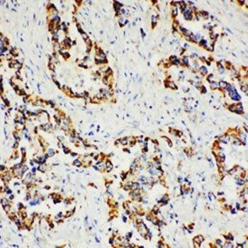 Paxillin/PXN Rabbit Polyclonal Antibody