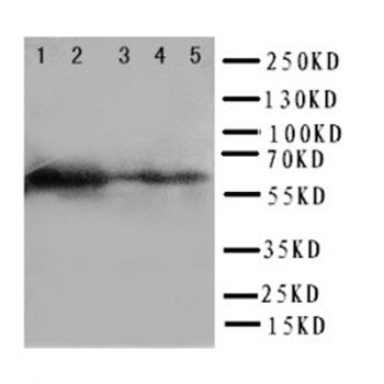 Paxillin/PXN Rabbit Polyclonal Antibody