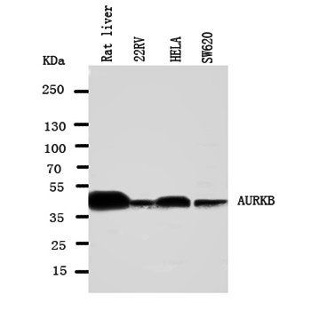 Aurora B/AURKB Rabbit Polyclonal Antibody