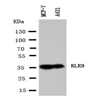 Kallikrein 9/KLK9 Rabbit Polyclonal Antibody
