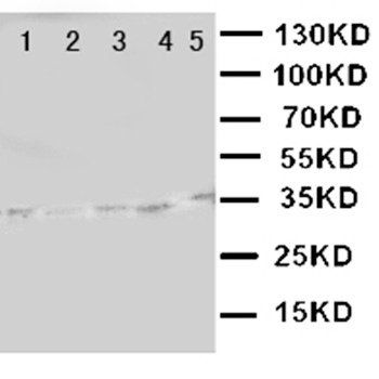 LOX 1/OLR1 Rabbit Polyclonal Antibody