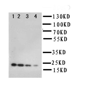 Interleukin-10 IL10/10 Rabbit Polyclonal Antibody
