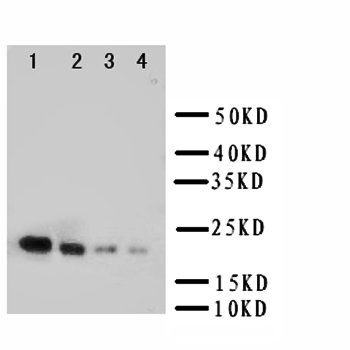 Interleukin-18 IL18/18 Rabbit Polyclonal Antibody
