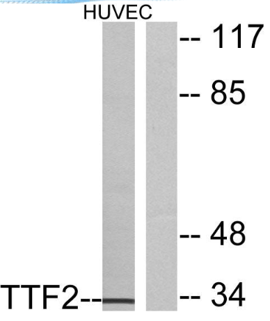 FoxE1 rabbit pAb Antibody