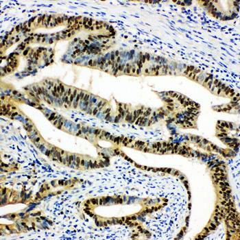 DUT Rabbit Polyclonal Antibody