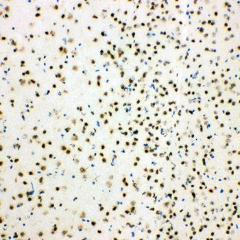 Histone deacetylase 3 HDAC3 Rabbit Polyclonal Antibody