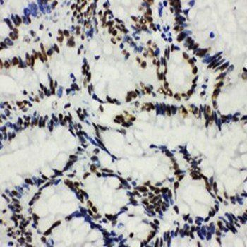 Histone deacetylase 3 HDAC3 Rabbit Polyclonal Antibody