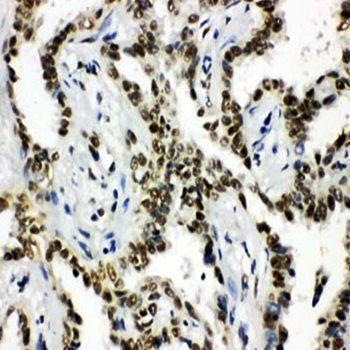 Histone deacetylase 3 HDAC3 Rabbit Polyclonal Antibody
