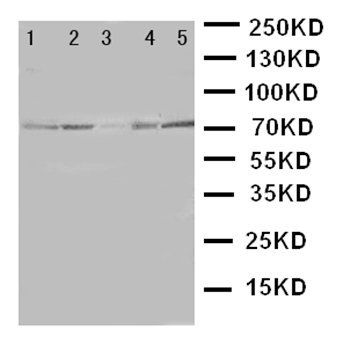 BCRP/ABCG2 Rabbit Polyclonal Antibody