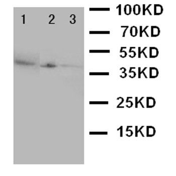 CD1a Rabbit Polyclonal Antibody