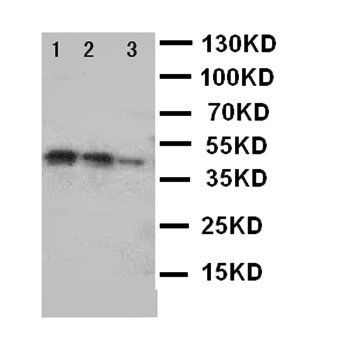 DDR2 Rabbit Polyclonal Antibody